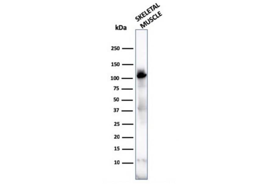 Western Blot - Anti-Sarcomeric Actinin alpha 2 Antibody [ACTN2/3292] - BSA and Azide free (A253628) - Antibodies.com
