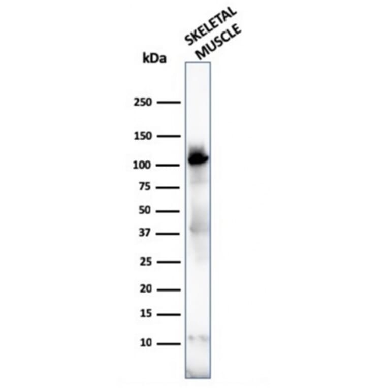 Western Blot - Anti-Sarcomeric Actinin alpha 2 Antibody [ACTN2/3292] - BSA and Azide free (A253628) - Antibodies.com