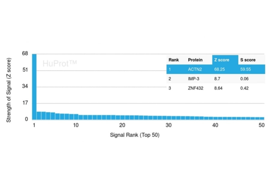 Protein Array - Anti-Sarcomeric Actinin alpha 2 Antibody [ACTN2/3292] - BSA and Azide free (A253627) - Antibodies.com