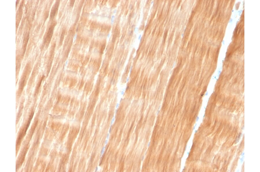 Immunohistochemistry - Anti-Sarcomeric Actinin alpha 2 Antibody [ACTN2/3293] - BSA and Azide free (A253629) - Antibodies.com