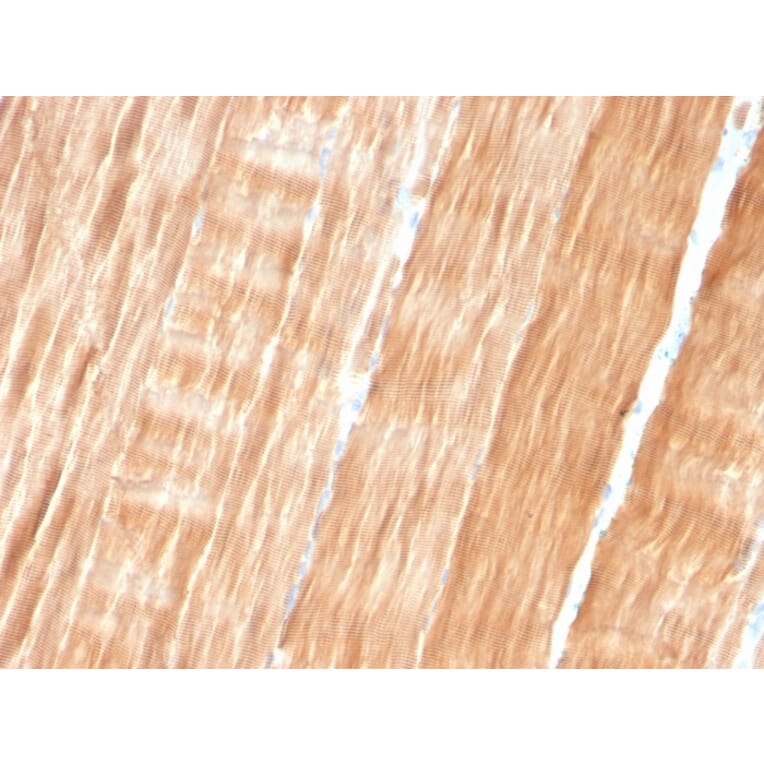 Immunohistochemistry - Anti-Sarcomeric Actinin alpha 2 Antibody [ACTN2/3293] - BSA and Azide free (A253629) - Antibodies.com