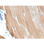 Immunohistochemistry - Anti-Sarcomeric Actinin alpha 2 Antibody [ACTN2/3293] - BSA and Azide free (A253629) - Antibodies.com