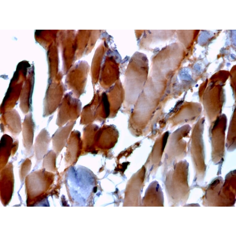 Immunohistochemistry - Anti-Sarcomeric Actinin alpha 2 Antibody [ACTN2/3293] - BSA and Azide free (A253629) - Antibodies.com