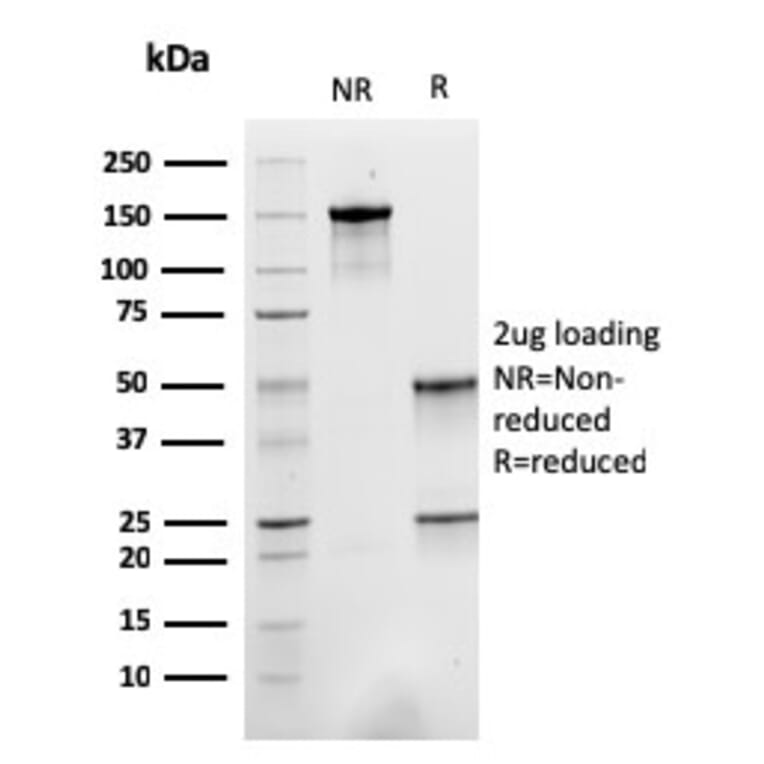 SDS-PAGE - Anti-Sarcomeric Actinin alpha 2 Antibody [ACTN2/3293] - BSA and Azide free (A253629) - Antibodies.com
