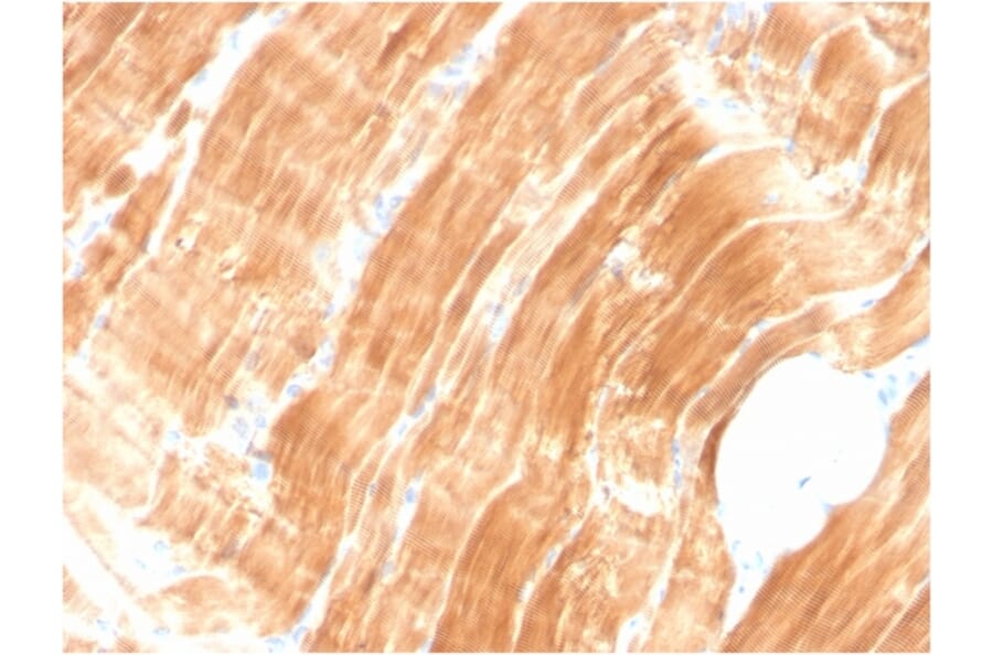 Immunohistochemistry - Anti-Sarcomeric Actinin alpha 2 Antibody [ACTN2/3294] - BSA and Azide free (A253630) - Antibodies.com