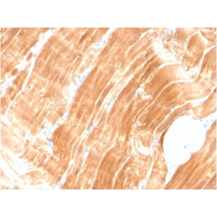 Immunohistochemistry - Anti-Sarcomeric Actinin alpha 2 Antibody [ACTN2/3294] - BSA and Azide free (A253630) - Antibodies.com