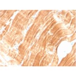 Immunohistochemistry - Anti-Sarcomeric Actinin alpha 2 Antibody [ACTN2/3294] - BSA and Azide free (A253630) - Antibodies.com