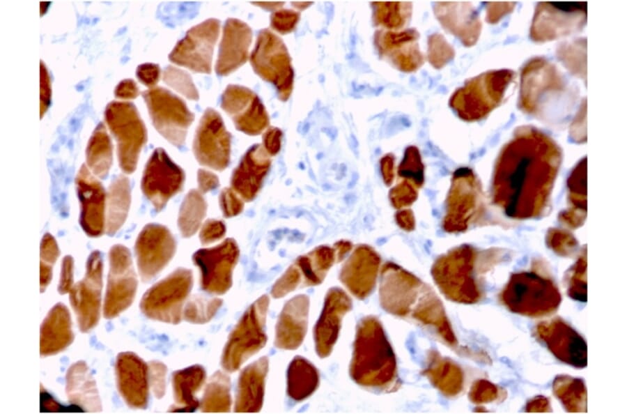 Immunohistochemistry - Anti-Sarcomeric Actinin alpha 2 Antibody [ACTN2/3294] - BSA and Azide free (A253630) - Antibodies.com