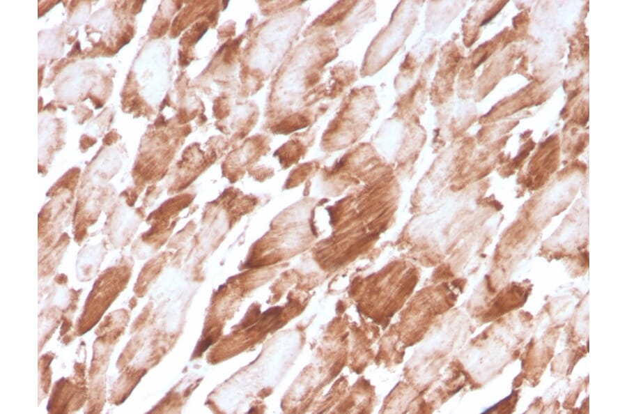 Immunohistochemistry - Anti-Sarcomeric Actinin alpha 2 Antibody [ACTN2/3294] - BSA and Azide free (A253630) - Antibodies.com