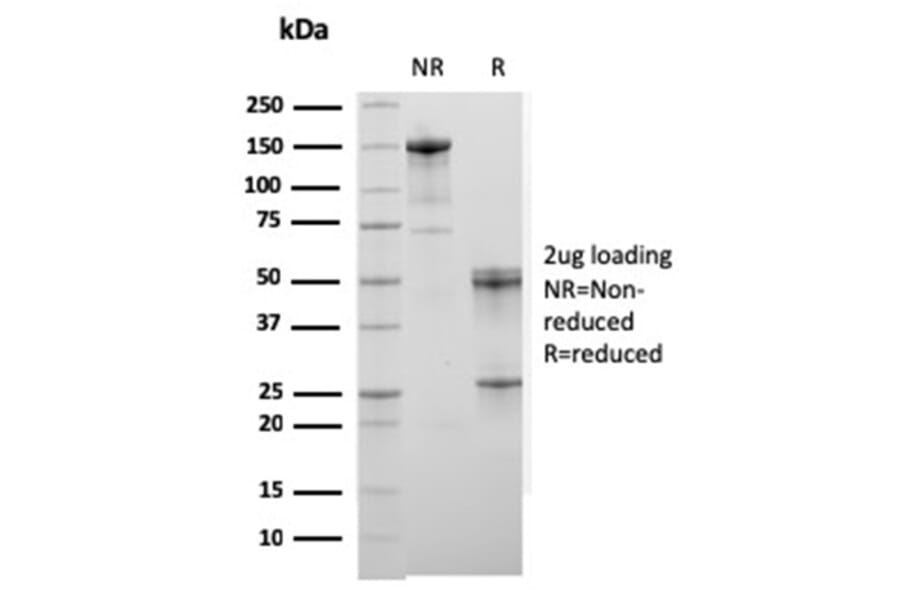 SDS-PAGE - Anti-Sarcomeric Actinin alpha 2 Antibody [ACTN2/3294] - BSA and Azide free (A253630) - Antibodies.com