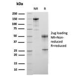 SDS-PAGE - Anti-Sarcomeric Actinin alpha 2 Antibody [ACTN2/3294] - BSA and Azide free (A253630) - Antibodies.com