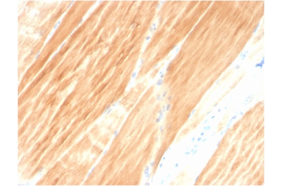 Immunohistochemistry - Anti-Sarcomeric Actinin alpha 2 Antibody [ACTN2/3295] - BSA and Azide free (A253631) - Antibodies.com