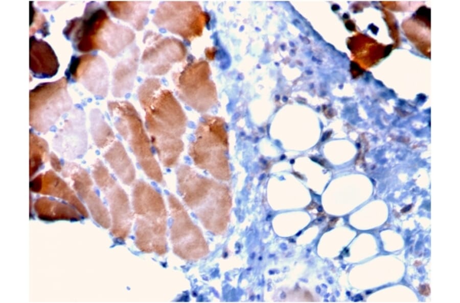 Immunohistochemistry - Anti-Sarcomeric Actinin alpha 2 Antibody [ACTN2/3295] - BSA and Azide free (A253631) - Antibodies.com