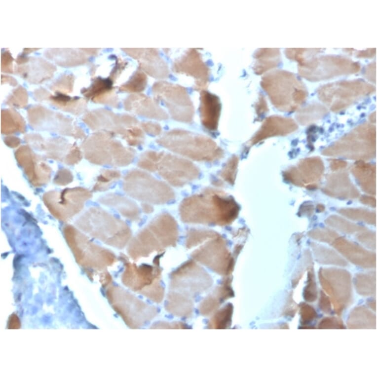 Immunohistochemistry - Anti-Sarcomeric Actinin alpha 2 Antibody [ACTN2/3295] - BSA and Azide free (A253631) - Antibodies.com
