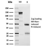 SDS-PAGE - Anti-Sarcomeric Actinin alpha 2 Antibody [ACTN2/3295] - BSA and Azide free (A253631) - Antibodies.com