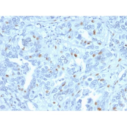 Immunohistochemistry - Anti-Cyclin A2 Antibody [CCNA2/2333] - BSA and Azide free (A253633) - Antibodies.com