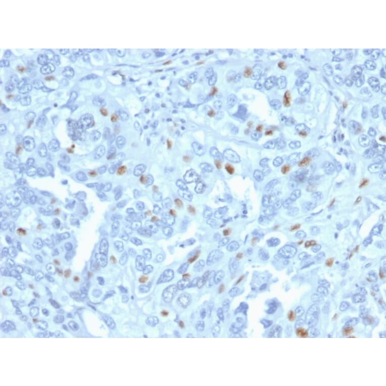 Immunohistochemistry - Anti-Cyclin A2 Antibody [CCNA2/2333] - BSA and Azide free (A253633) - Antibodies.com