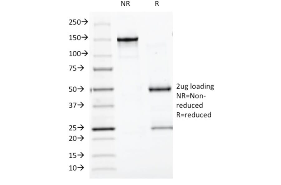 SDS-PAGE - Anti-BCL10 Antibody [BL10/411] - BSA and Azide free (A253634) - Antibodies.com