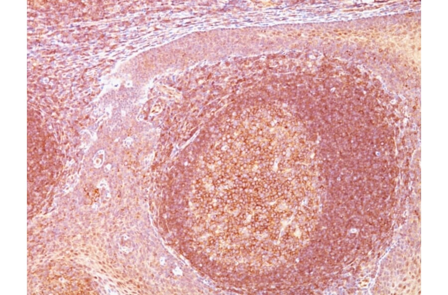 Immunohistochemistry - Anti-BCL10 Antibody [SPM520] - BSA and Azide free (A253634) - Antibodies.com