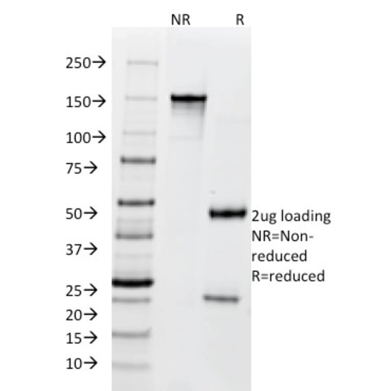 SDS-PAGE - Anti-BCL10 Antibody [SPM520] - BSA and Azide free (A253635) - Antibodies.com