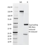 SDS-PAGE - Anti-BCL10 Antibody [SPM520] - BSA and Azide free (A253635) - Antibodies.com