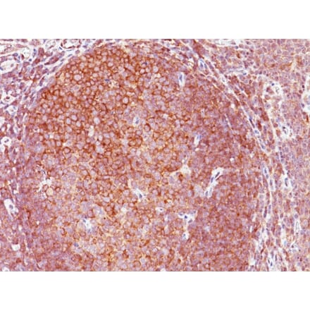 Immunohistochemistry - Anti-BCL10 Antibody [151] - BSA and Azide free (A253635) - Antibodies.com