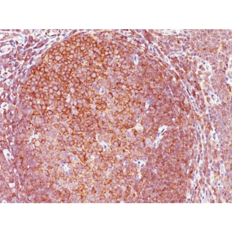 Immunohistochemistry - Anti-BCL10 Antibody [151] - BSA and Azide free (A253635) - Antibodies.com