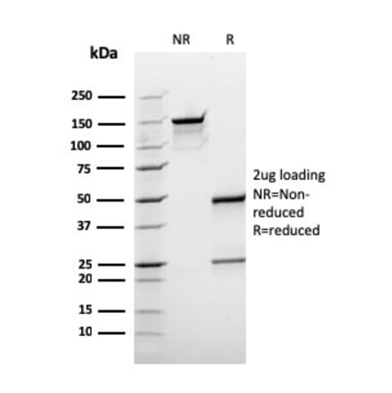SDS-PAGE - Anti-BCL10 Antibody [rBL10/411] - BSA and Azide free (A253637) - Antibodies.com
