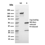 SDS-PAGE - Anti-BCL10 Antibody [rBL10/411] - BSA and Azide free (A253637) - Antibodies.com
