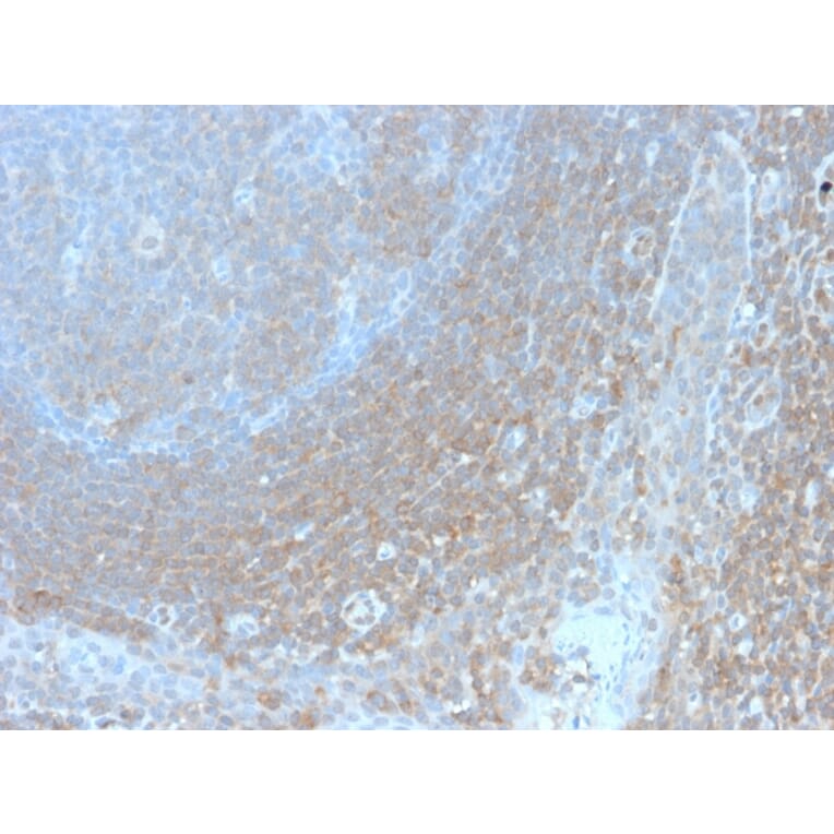 Immunohistochemistry - Anti-BCL10 Antibody [BL10/2988R] - BSA and Azide free (A253638) - Antibodies.com