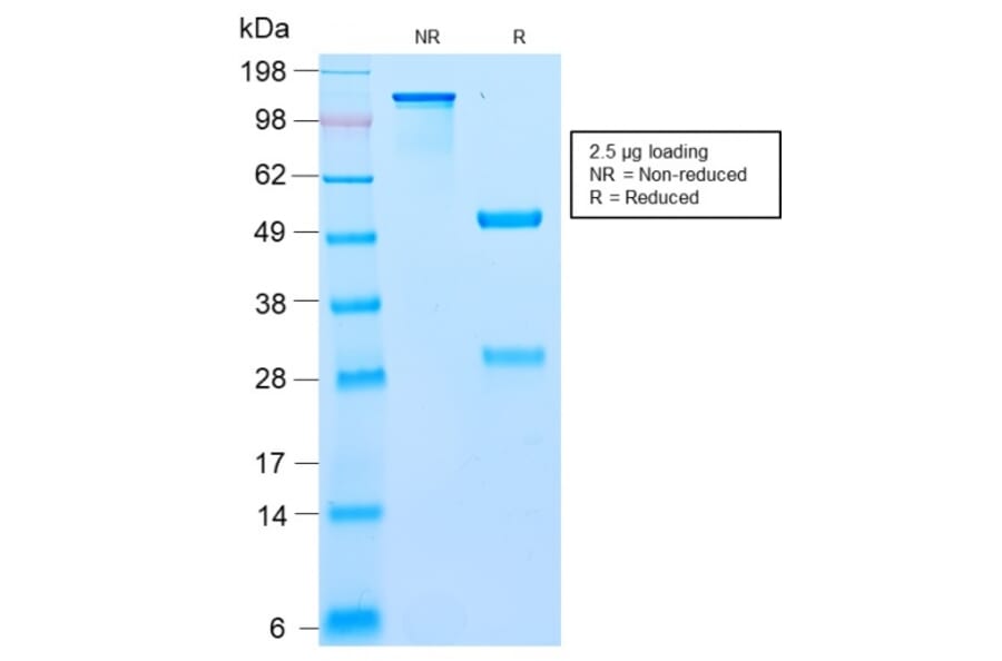SDS-PAGE - Anti-BCL10 Antibody [BL10/2988R] - BSA and Azide free (A253638) - Antibodies.com