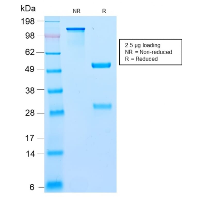 SDS-PAGE - Anti-BCL10 Antibody [BL10/2988R] - BSA and Azide free (A253638) - Antibodies.com