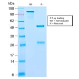 SDS-PAGE - Anti-BCL10 Antibody [BL10/2988R] - BSA and Azide free (A253638) - Antibodies.com