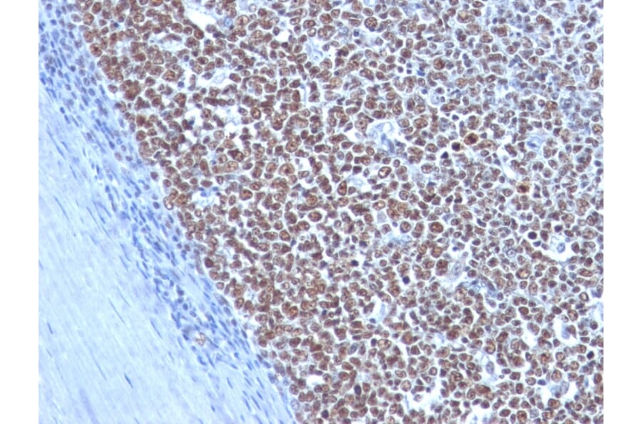 Immunohistochemistry - Anti-Cyclin B1 Antibody [CCNB1/1098] - BSA and Azide free (A253640) - Antibodies.com