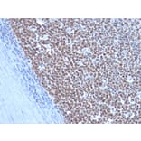Immunohistochemistry - Anti-Cyclin B1 Antibody [CCNB1/1098] - BSA and Azide free (A253640) - Antibodies.com
