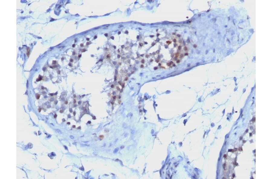 Immunohistochemistry - Anti-Cyclin B1 Antibody [CCNB1/1098] - BSA and Azide free (A253640) - Antibodies.com