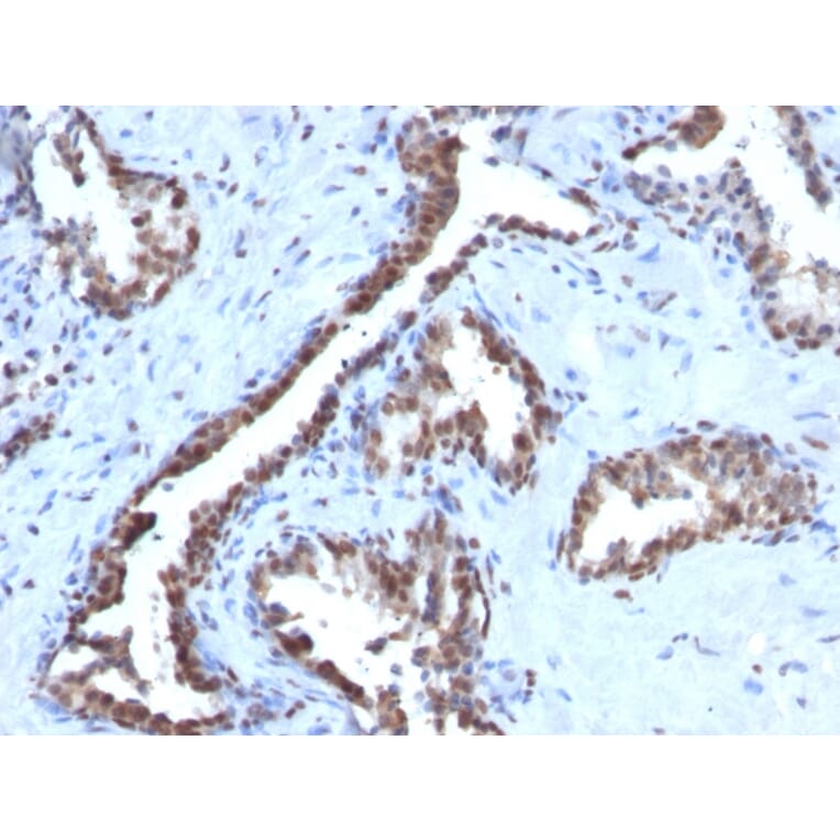 Immunohistochemistry - Anti-Cyclin B1 Antibody [CCNB1/1098] - BSA and Azide free (A253640) - Antibodies.com