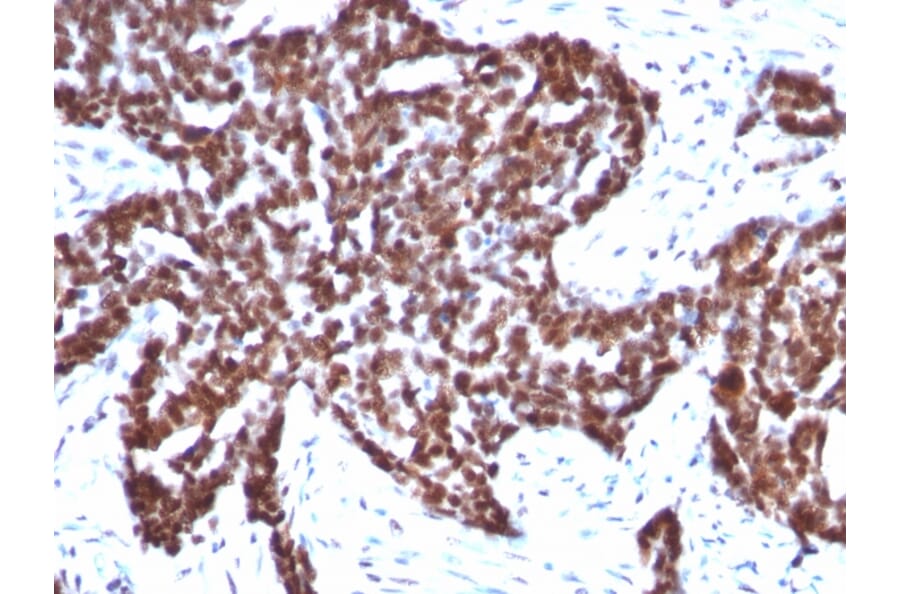 Immunohistochemistry - Anti-Cyclin B1 Antibody [CCNB1/1098] - BSA and Azide free (A253640) - Antibodies.com