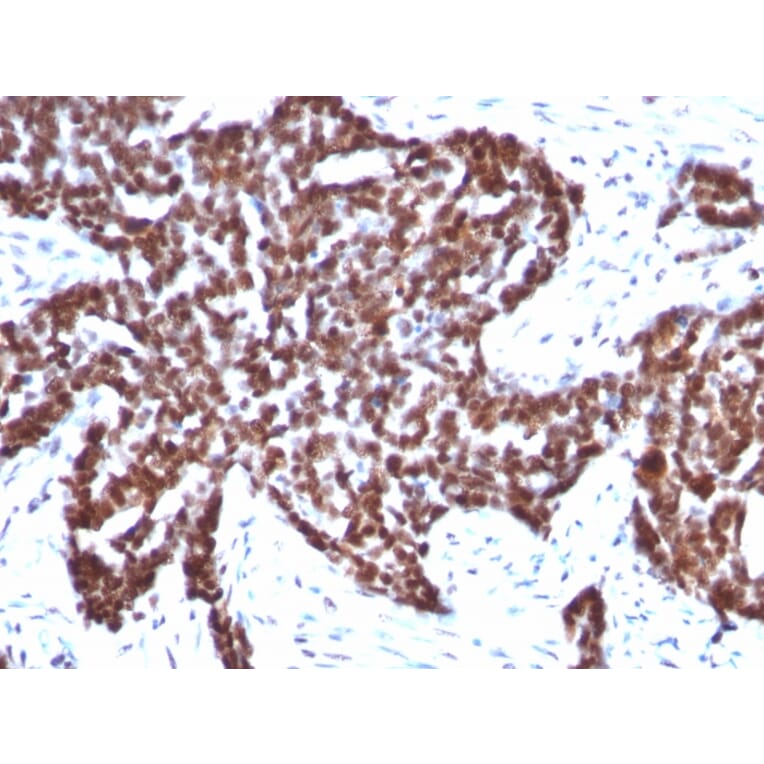 Immunohistochemistry - Anti-Cyclin B1 Antibody [CCNB1/1098] - BSA and Azide free (A253640) - Antibodies.com