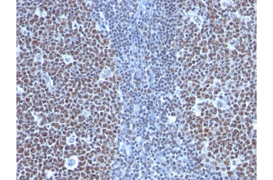 Immunohistochemistry - Anti-Cyclin B1 Antibody [SPM619] - BSA and Azide free (A253641) - Antibodies.com