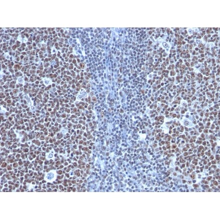Immunohistochemistry - Anti-Cyclin B1 Antibody [SPM619] - BSA and Azide free (A253641) - Antibodies.com