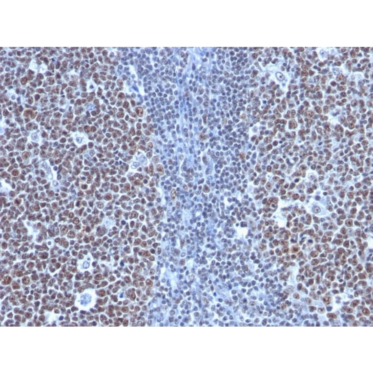 Immunohistochemistry - Anti-Cyclin B1 Antibody [SPM619] - BSA and Azide free (A253641) - Antibodies.com