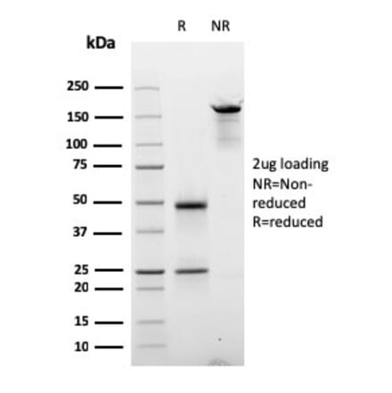 SDS-PAGE - Anti-Cyclin D2 Antibody [CCND2/2620] - BSA and Azide free (A253642) - Antibodies.com