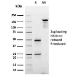 SDS-PAGE - Anti-Cyclin D2 Antibody [CCND2/2620] - BSA and Azide free (A253642) - Antibodies.com