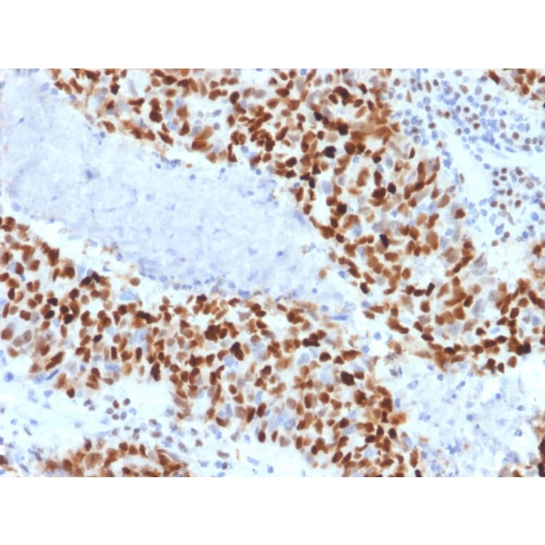 Immunohistochemistry - Anti-Cyclin E Antibody [CCNE1/2460] - BSA and Azide free (A253643) - Antibodies.com