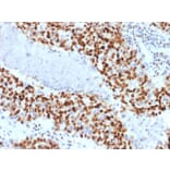 Immunohistochemistry - Anti-Cyclin E Antibody [CCNE1/2460] - BSA and Azide free (A253643) - Antibodies.com