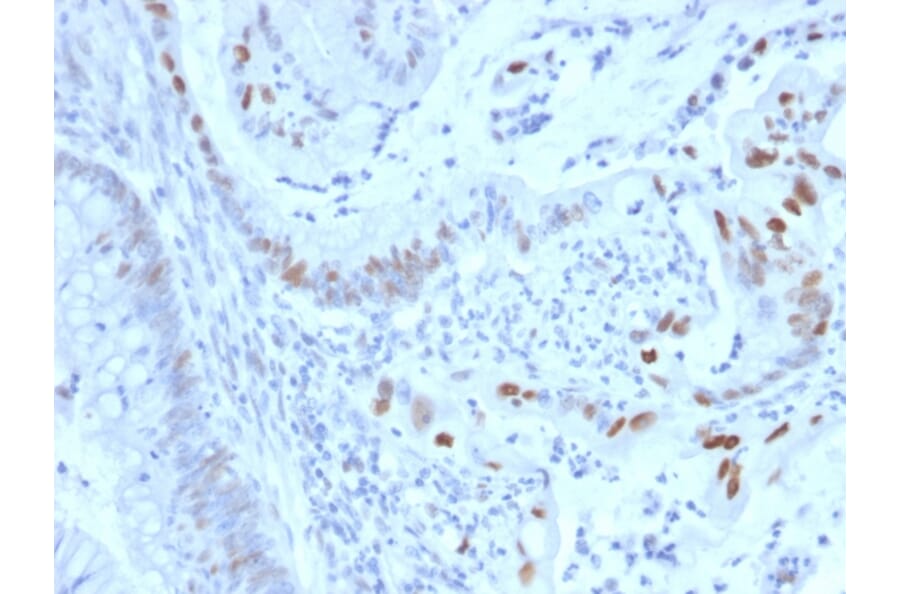 Immunohistochemistry - Anti-Cyclin E Antibody [CCNE1/2460] - BSA and Azide free (A253643) - Antibodies.com