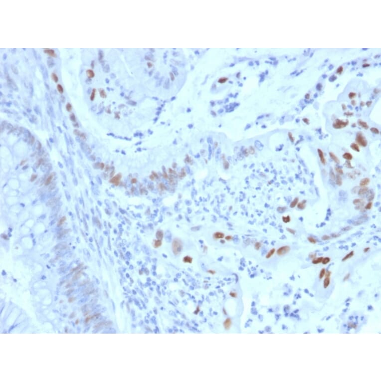 Immunohistochemistry - Anti-Cyclin E Antibody [CCNE1/2460] - BSA and Azide free (A253643) - Antibodies.com