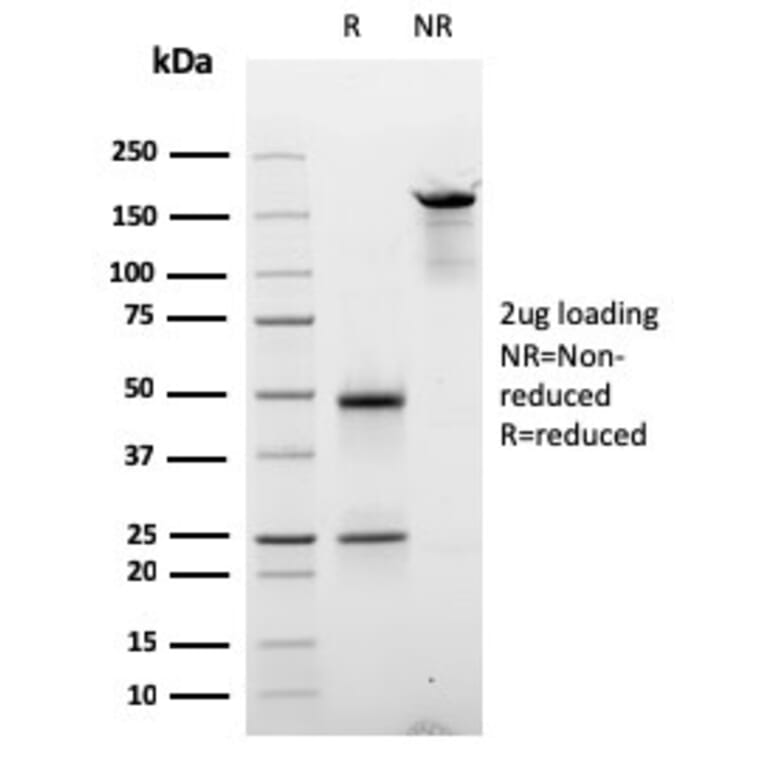 SDS-PAGE - Anti-Cyclin E Antibody [CCNE1/2587] - BSA and Azide free (A253643) - Antibodies.com