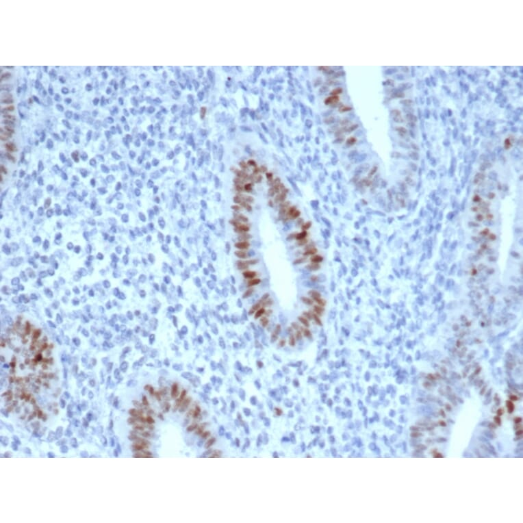 Immunohistochemistry - Anti-Cyclin E Antibody [CCNE1/4935R] - BSA and Azide free (A253644) - Antibodies.com